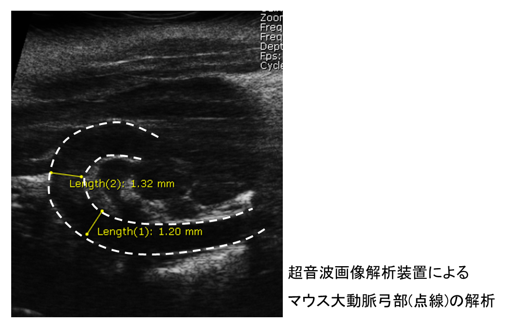 マウス大動脈弓のエコー画像