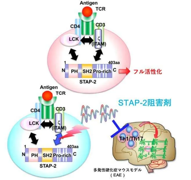 新たな自己免疫疾患治療戦略